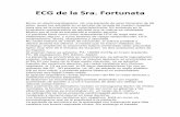 ECG de la Sra. Fortunata - fiaiweb.comfiaiweb.com/wp-content/uploads/2017/07/ECG-de-la-Sra-Fortunata.pdf · La paciente tiene como único antecedente HTA de larga data sin tratamiento