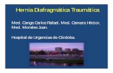 Hernia Diafragmática Traumática - SORDIC 2017congreso.sordic.org.ar/uploads/2014/poster/2014_304_PC_Torax.pdf · Introducción • Prevalencia: – 0,8 al 8% del trauma cerrado