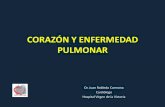 CORAZÓN Y ENFERMEDAD PULMONAR - Inicio€¦ · (amígdalas hipertróficas, poliposis nasal, malformaciones maxilofaciales) -El SAHS produce grados variables de hipoxemia e hipercapnia