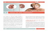 figuran en el glosario. · Información a pacientes - Cáncer de riñón metastásico Página 2 / 12 Fig. 1: El cáncer de riñón metastásico puede extenderse a los pulmones, huesos,