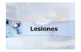 Lesiones - Emagister · CLASIFICACION DE LOS OBJETOS CONTUNDENTES: NATURALES: Palos, piedras, terrones, animales ( serpientes, ... MEDICO LEGAL DE LAS LESIONES OSEAS El 75% de fracturas