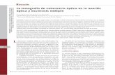 La tomografía de coherencia óptica en la neuritis óptica …revistaesclerosis.es/pdf/partes/v1_6abr08_3.pdf · en la sustancia blanca de apariencia normal y en la sustancia gris