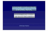 ENFERMEDAD OSEA DE BAJO RECAMBIO - Servicio …nefrohospbritanico.org.ar/clases/ENF_OSEA_ADINAMICA.pdf · DP Y ENFERMEDAD OSEA ADINAMICA Mayor proporción de diabéticos ... Factores