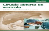 Cirugía abierta de vesícula (PDF) · Problemas del conducto biliar común El conducto biliar común está formado por la unión de los conduc tos que se extienden desde el hígado