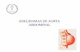 ANEURISMAS DE AORTA ABDOMINAL - asturias.es Publica... · Definición de aneurisma de aorta abdominal un diámetro igual o superior a ... Se pueden palpar, si el ... define el cribado