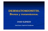 DERMATOMIOSITIS. Brotes y tratamientos. - fesemi.org · Presentación clínica 2005 Dic Edema en ambos hombros que cede . Después tumefacción muñeca izda y tobillo sin signos inflamatorios