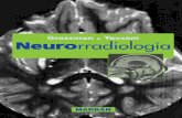 Neurorradiología - LaLeo.com · infartos, infecciones y procesos desmielinizantes del encéfalo y la columna. Hemos procurado ofrecer algo más que una mera descripción de las diferentes
