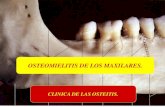 OSTEOMIELITIS DE LOS MAXILARES. - Página …odontogen08.weebly.com/uploads/9/0/3/3/9033841/osteomielitis.pdf · osteomielitis de los maxilares. clinica de las osteitis. terminologia.