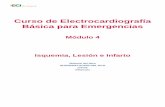 Curso de Electrocardiografía Básica para Emergenciaseciemergencias.com/.../uploads/2017/06/Material-Clase-4-ECG-2017.pdf · ISQUEMIA La isquemia es la falta de suficiente sangre