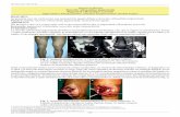 Rev Nac 2015; 7(2): 54-55 IMAGENES EN MEDICINA Sinovitis ...scielo.iics.una.py/pdf/hn/v7n2/v7n2a12.pdf · Se presenta caso de varón joven con monoartritis aguda debido a sinovitis