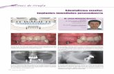 Edentulismo maxilar. Implantes inmediatos posexodoncia · reconstruidos con perno y corona, con afectación periodontal. En la mandíbula lleva dos implantes colocados en otra clínica,