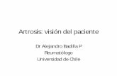 Artrosis: visión del paciente - volarchile.cl · Universidad de Chile . DEFINICIÓN • Grupo de condiciones de causa desconocida, que afectan las articulaciones sinoviales, con