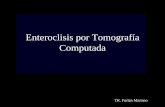 Enterocisis por Tomografía Computadatecnologiasradiologicas.com/descargas/Enterocisis por TC.pdf · Enteroclisis por Tomografía Computada Enteroclisis por Rx Enteroclisis por TC