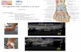 Ecografía del tobillo y el pie. Tendón de Aquiles · Ecografía del tobillo y el pie. Tobillo Ligamento deltoideo Fascículo tibio-astragalino del ligamento deltoideo Fascículo