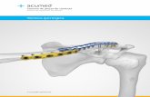 Sistema de reparación Acu-Sinch® - acumed.net · es una sutura UHMWPE (polietileno de peso molecular ultra alto) del n.º 5 no reabsorbible. Anclaje Premontado en el destornillador