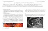 Diagnóstico endoscópico de perforación asintomática de ...scielo.isciii.es/pdf/diges/v108n5/es_imagenes3.pdf · gen anal se encontraron multitud de divertículos colónicos, uno