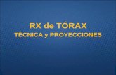 RX de TÓRAXradiologiahospitalpuntaeuropa.com/.../Presentación-ppt-del-tema-1.pdf · TÉCNICA Y PROYECCIONES • PA (posteroanterior) –Técnica: • Paciente está de pié y apoya
