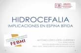 HIDROCEFALIA IMPLICACIONES EN ESPINA BÍFIDA - anpheb.esanpheb.es/wp-content/uploads/2016/06/PONENCIA-HIDROCEFALIA.pdf · hidrocefalia implicaciones en espina bÍfida antonio lÓpez