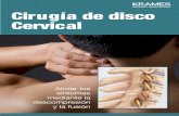 Cirugía de disco cervical (PDF) - veteranshealthlibrary.org · herniada del disco puede presionar los nervios cerca nos. Esto puede causar dolor en el cuello o en el brazo, o debilidad