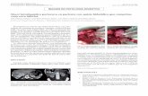 Shunt intrahepático portocava en paciente con quiste ...scielo.isciii.es/pdf/diges/v109n11/es_imagen.pdf · IMAGEN EN PATOLOGÍA DIGESTIVA Shunt intrahepático portocava en paciente
