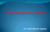 Dr. José Alberto Aguilar - Blog de información y ...Técnica de Cementado Terminada la preparación colocar capa de adhesivo minimiza la sensibilidad y previene contaminación con