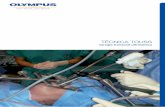 Cirugía transoral ultrasónica - TOUSSProjecttoussproject.com/wp-content/uploads/2017/12/TOUSS_catalo...o a la derecha del cirujano según sea necesario. El generador de ultrasonidos/bipolar