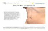 Implantes de glúteos · para aumentar el volumen de los glúteos: la transferencia de grasa y los implantes. Mediante la transferencia de grasa, se quita grasa corporal de un área