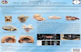 revista.med.unlp.edu.arrevista.med.unlp.edu.ar/archivos/201512/posters/p_Anato3d.pdf · externa del órgano estudiado. Cerebelo, vista lateral. Corazón fetal, vista anterior. Feto,