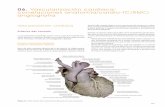 06. Vascularización cardíaca: correlaciones anatomía ... · (Apex cordis) Tronco braquiocefálico (Truncus brachiocephalicus) Arteria carótida común izquierda (Arteria carotis