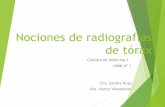 Universidad Nacional de Córdoba - Dra. Nancy …semiologiahnc.webs.fcm.unc.edu.ar/files/2019/06/2019...ALTERACIONES EN LA RX DE TORAX PATRON INTERSTICIAL HALLAZGOS RADIOLOGICOS Engrosamiento