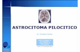 TUMORI CEREBRALI IN TRATTAMENTO - Rete Oncologica · 2014-11-05 · Astrocitoma Cerebellare INTRODUZIONE CASO CLINICO DIAGNOSI E TRATTAMENTO •15% delle neoplasie encefaliche pediatriche