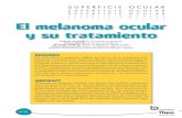 El melanoma ocular y su tratamiento - Laboratorios …...El melanoma ocular y su tratamiento Nº:30 RESUMEN Los melanomas son neoplasias malignas que derivan de los melanocitos den