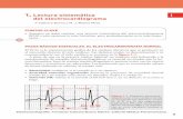 1 Lectura sistemática I del electrocardiograma · 4 Sección I. Abordaje inicial I • Complejo QRS: analizar si es de duración normal o aberrante (si es superior a 100-120 ms),