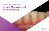 Experto Universitario en Cirugía Mucogingival en Periodoncia · 3.5.3. Tipos, características y manejo. Módulo 4. Tratamiento periodontal reconstructivo VI: cirugía plástica