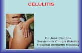 CELULITIS - Dr. Cambria · permitir que la grasa acumulada en la zona tratada salga a la sangre ayudando a drenar hacia el canal linfático los desechos que tenemos en la piel. Esta