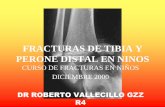FRACTURAS DE TIBIA Y PERONE DISTAL EN NINOS - MICmic.com.mx/ortopedia/img/pdf/pediatria1/FracturasdeTibia... · 2013-12-11 · corta met-diaf. clasificacion por mecanismo de lesion