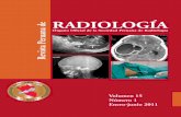 RADIOLOGÍA Revista Peruana de · – Monocitos 8 6 4 9 4 3 2 1 – Eosinófilos 1 1 1 0 0 1 – Basófilos 0 1 3 0 0 1 0 – Segmentados 50 48 56 60 64 ... Figura 1. Múltiples lesiones