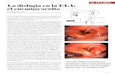 pag1 - Servicio de Neumologíaneumoclinicovalencia.com/ADELANTE_Ago2017_revista_adela_cv.pdf · durante un catarro se acumula moco en los bronquios y es nece- sario expectorarlo.