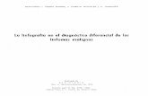 Lo linfogrofío en el diagnóstico diferencial de los ... · DOCTORES J. CELMA MARIN, J. GARCIA NOVALES y C. VAZQUEZ Lo linfogrofío en el diagnóstico diferencial de los linfomos