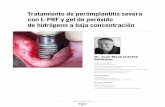 Tratamiento de periimplantitis severa con L-PRF y gel de peróxido … · 2019-01-28 · noviembre150 2018 Tratamiento de periimplantitis severa con L-PRF y gel de peróxido de hidrógeno