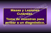 Masas y Lesiones Cutáneas. Toma de muestras para arribar a un …laboduchene.com/Biopsiacutanea-face.pdf · 2013-08-20 · La biopsia cutánea puede ser concluyente u orientativa.