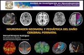 NEUROIMAGEN NEONATAL Y PEDIÁTRICA DEL …...PANORAMA GENERAL 1. Introducción 2. Patrones neuropatológicos mas frecuentes en el periodo perinatal 3. Neuroimagen convencional: Ultrasonido