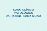 CASO CLÍNICO PATOLÓGICO Dr. Rodrigo Torres Muñoz · CASO CLÍNICO PATOLÓGICO ... • Hombre de 38 años de edad quién inicio su padecimiento actual en 1994, presentó cefalea