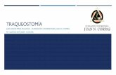 TRAQUEOSTOMÍAa.pdf · TRAQUEOSTOMÍA PERCUTÁNEA Consiste en la introducción de una cánula traqueal Mediante disección roma de tejidos pretraquales Utilizando una guía por técnica