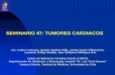 SEMINARIO 47: TUMORES CARDIACOS · Tumores Cardiacos Introducción. Los tumores cardíacos primarios constituyen una patología muy poco frecuente 97% de los casos son benignos. Prevalencia: