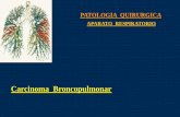 Carcinoma Broncopulmonar - UCM Cancer...2014/03/27  · Neumo. Dcha. N.R. N 2chy Fase D N 1hiliar MEDIASTINOSCOPIA PRONOSTICA Objetivo Obtención de biopsias ganglionares de las regiones