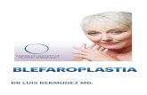 BLEFAROPLASTIA · 2020-06-10 · La blefaroplastia, es un procedimiento quirúrgico para mejorar la apariencia de los párpados. Puede ser realizado en los párpados inferiores, superiores