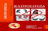 DICIÓN ESPECIAL Revista Peruana de RADIOLOGÍA SOCPR EDICIÓN... · 2020-06-29 · Órgano Oficial de la Sociedad Peruana de Radiología Revista Peruana de RADIOLOGÍA 2- TENUE OPACIDAD