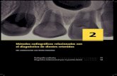 Métodos radiográficos relacionados con el diagnóstico de ...Métodos radiográficos relacionados con el diagnóstico de dientes retenidos 13 Fig. 2.4 A. La vista periapical muestra