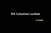 RX Columna Lumbar · RX Columna Lumbar Oblicua . Cuerpo vertebral L1 L5 Pedículo Proceso articular superior Proceso articular inferior Proceso espinoso ... Foramen intervertebral